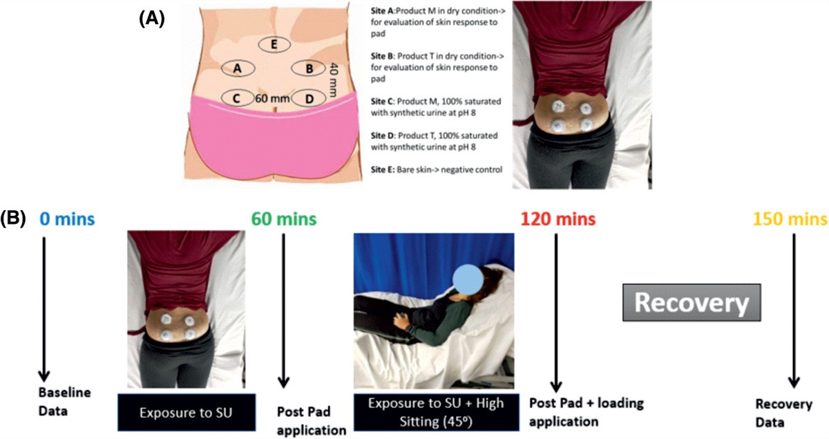 The Effects of Incontinence Pad Application on Loaded Skin With Reference to Biophysical and Biochemical Parameters: An Exploratory Cohort Study Using a Repeated-Measures Design
