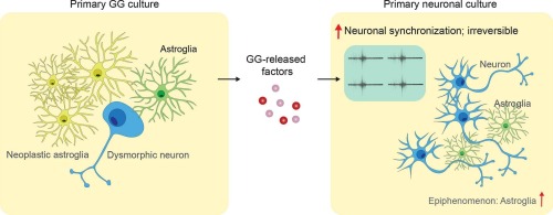Ganglioglioma cells potentiate neuronal network synchronicity and elicit burst discharges via released factors