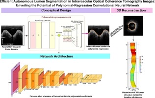 Efficient Autonomous Lumen Segmentation in Intravascular Optical Coherence Tomography Images: Unveiling the Potential of Polynomial-Regression Convolutional Neural Network