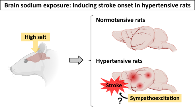 Brain sodium exposure: inducing stroke onset independent of blood pressure elevation in stroke-prone spontaneously hypertensive rats