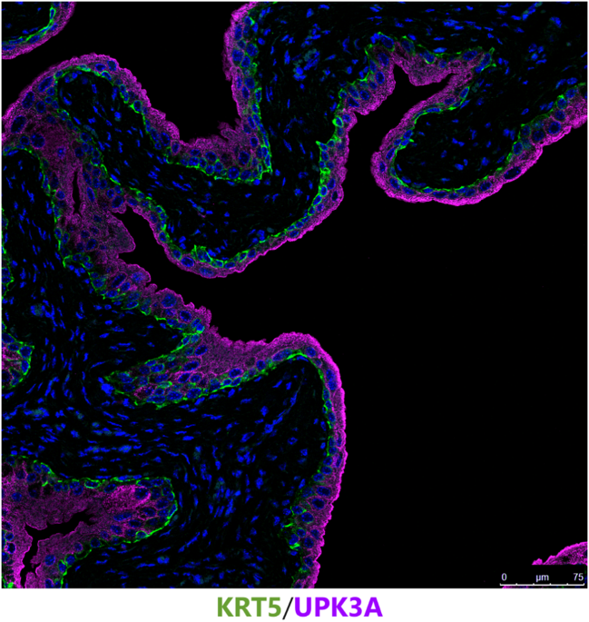 The urothelial gene regulatory network: understanding biology to improve bladder cancer management