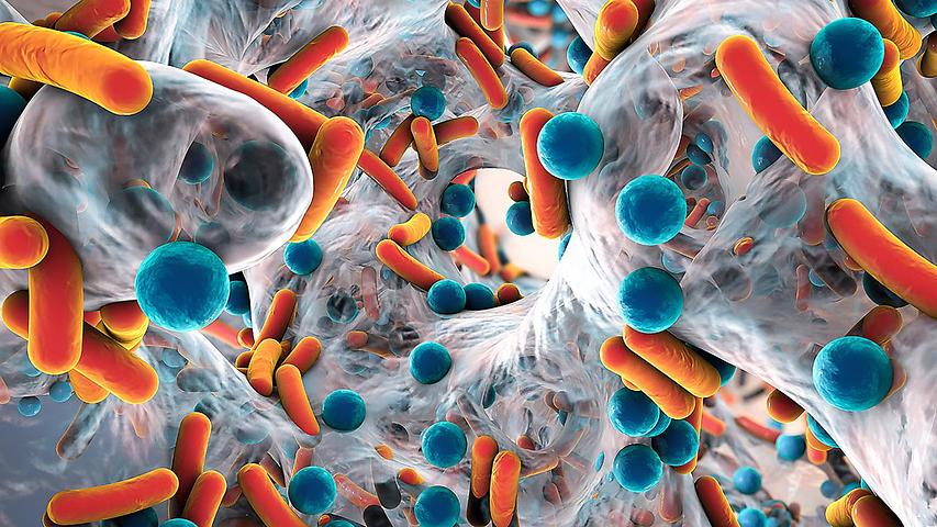 “A little less conversation, a little more action please” – we need to tackle antimicrobial resistance