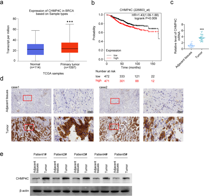 Chromatin-modifying protein 4C (CHMP4C) affects breast cancer cell growth and doxorubicin resistance as a potential breast cancer therapeutic target