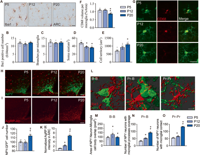Microglia shape AgRP neuron postnatal development via regulating perineuronal net plasticity