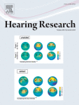 Age-Related Changes of Auditory Sensitivity Across the Life Span of CBA/CaJ Mice