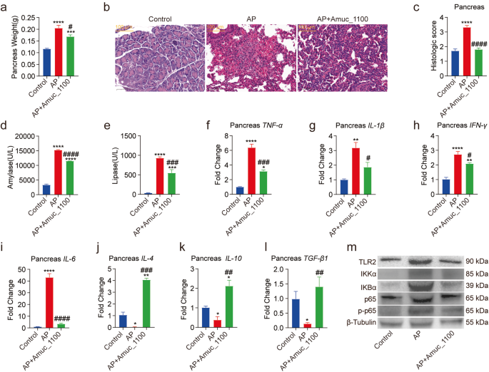 Amuc_1100 pretreatment alleviates acute pancreatitis in a mouse model through regulating gut microbiota and inhibiting inflammatory infiltration