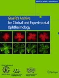 Quantitative evaluation of retinal and choroidal vascularity in systemic lupus erythematosus by SS-OCT/OCTA