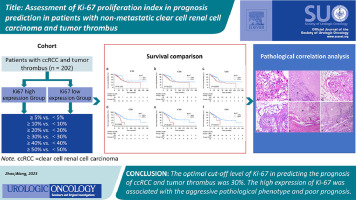 Assessment of Ki-67 proliferation index in prognosis prediction in patients with nonmetastatic clear cell renal cell carcinoma and tumor thrombus