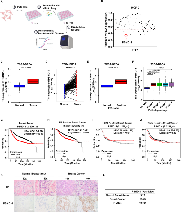 PSMD14 stabilizes estrogen signaling and facilitates breast cancer progression via deubiquitinating ERα