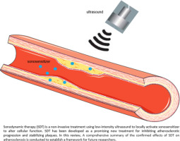 Sonodynamic therapy for the treatment of atherosclerosis