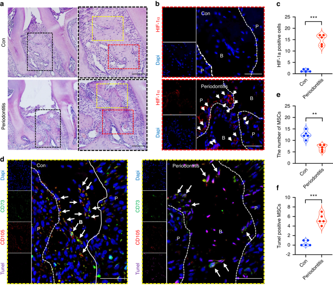 Mesenchymal stem cell-derived apoptotic bodies alleviate alveolar bone destruction by regulating osteoclast differentiation and function
