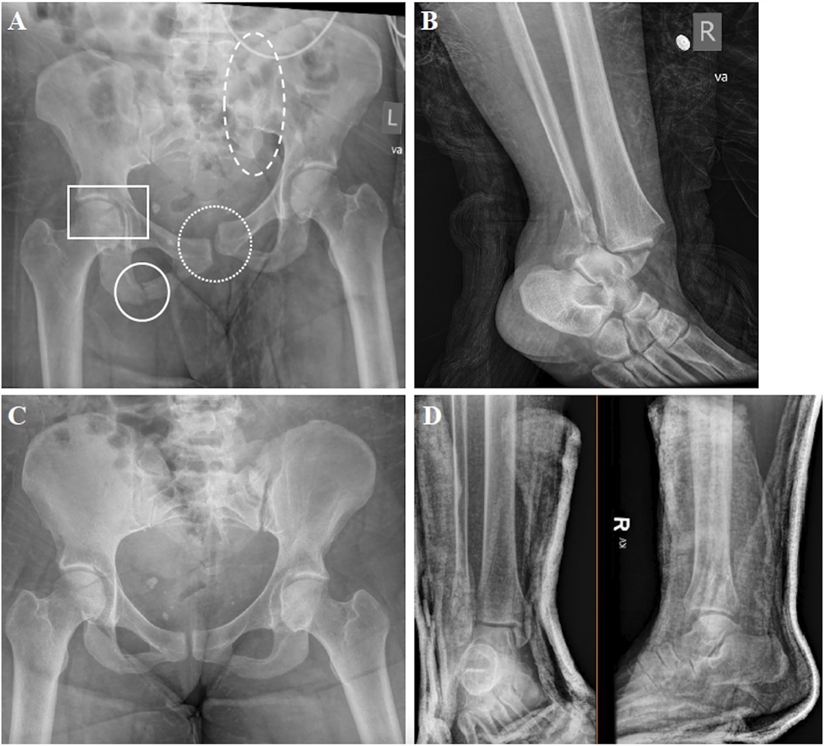 Capacity and Declination of Care in the Surgical Patient