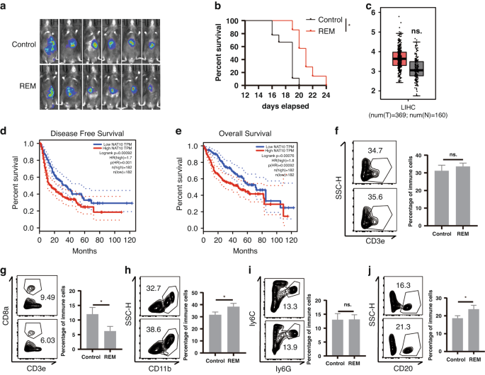 Downregulation of N4-acetylcytidine modification in myeloid cells attenuates immunotherapy and exacerbates hepatocellular carcinoma progression
