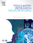 Effects of Cortisol Administration on Resting-State Functional Connectivity in Women with Depression